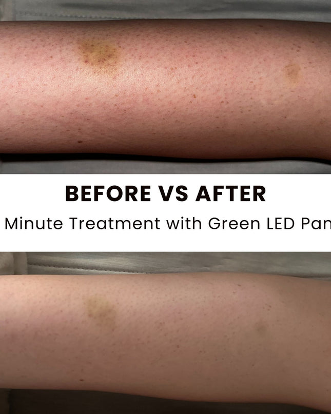 Lumara Illuminate Green – High-Performance 525 nm LED Therapy Panel